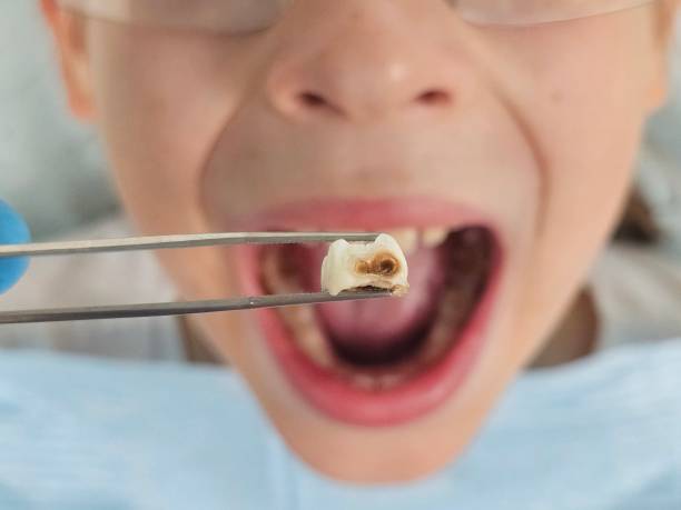 Best Emergency Cosmetic Dentistry (e.g., broken veneers) in Columbus Grove, OH